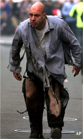 Stunned survivor of Boston Bombing.  (AP) 