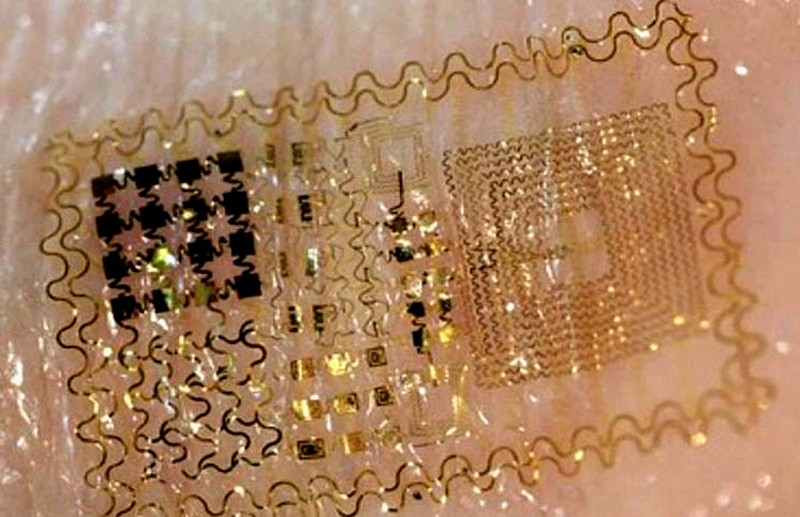 "The discovery uses a synthetic polymer which contains self-healing properties that mimic human skin. This means that electronic skin wounds can heal themselves in a short amount of time. It is capable of healing itself in just one day." - Interesting Engineering 